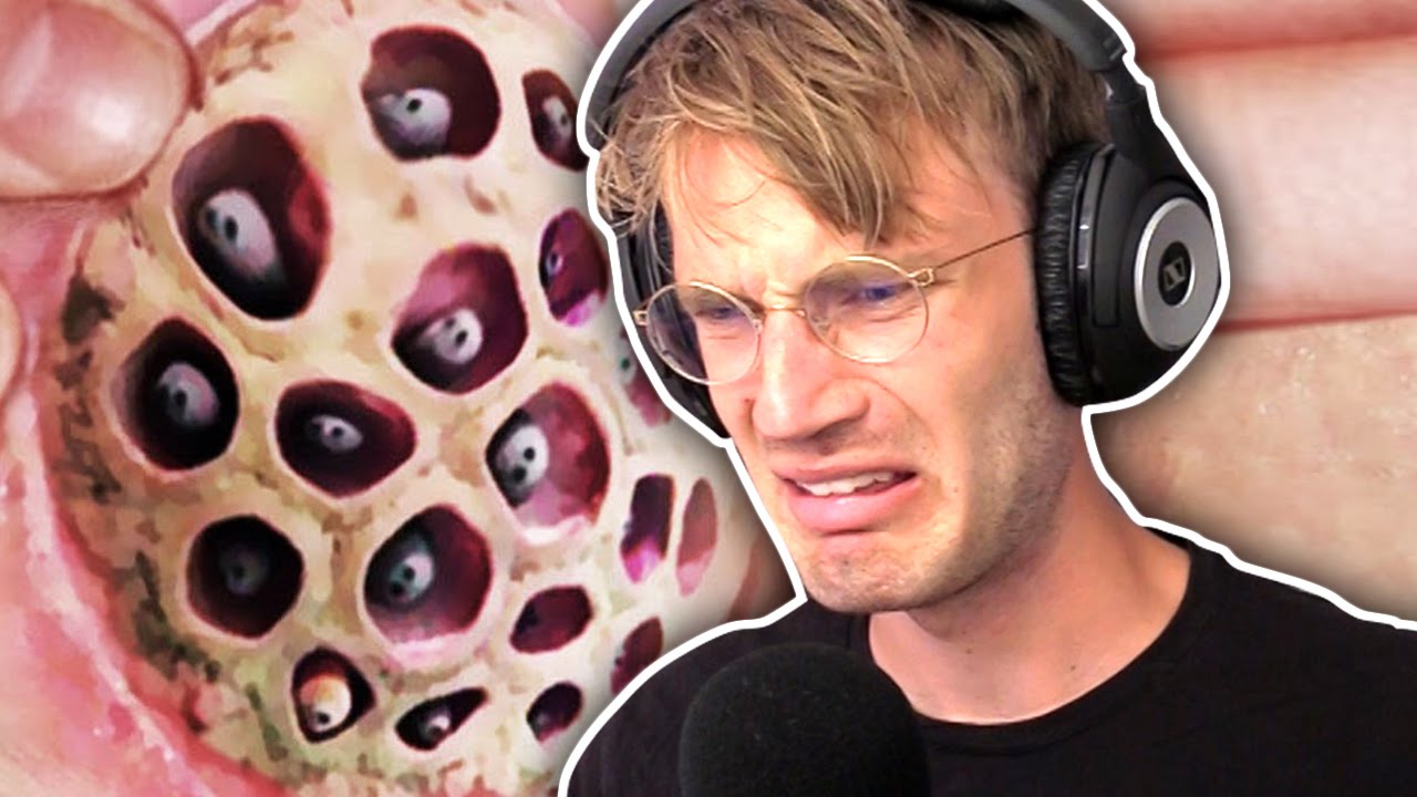 Celebrities Who Are Trypophobes