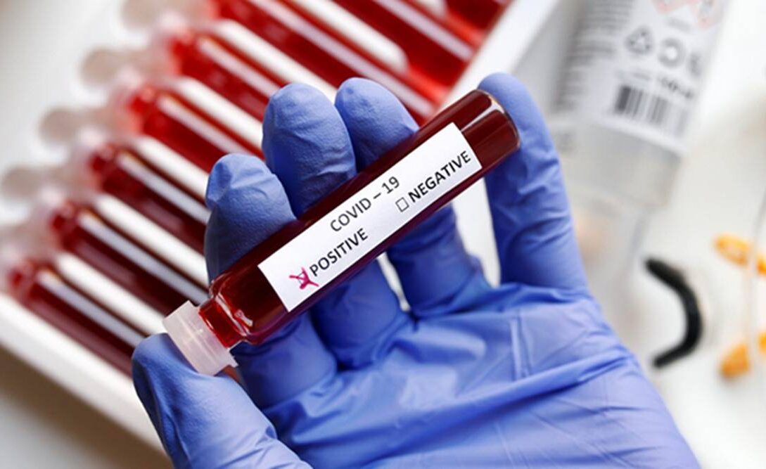 test kits 1200 1 - voozon.com