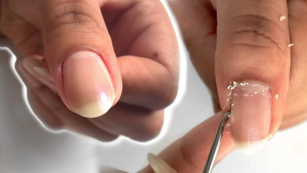 Try a cuticle conditioner