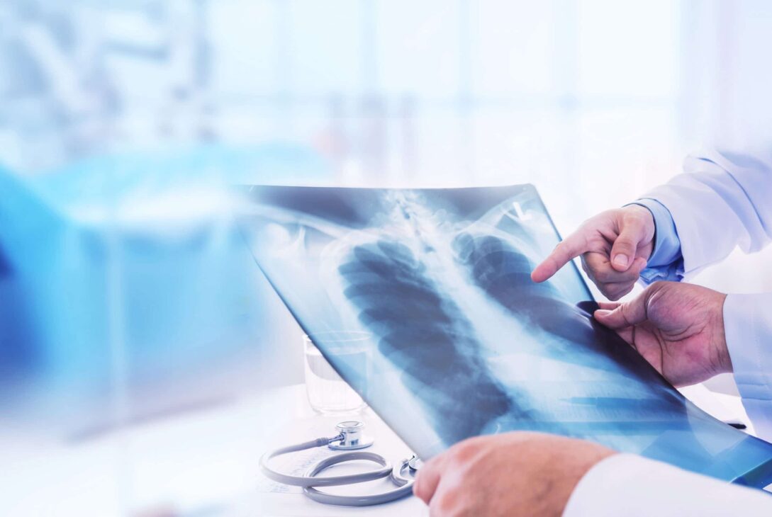 Why Mesothelioma Has Been in the News Recently - voozon.com