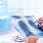 Why Mesothelioma Has Been in the News Recently - voozon.com