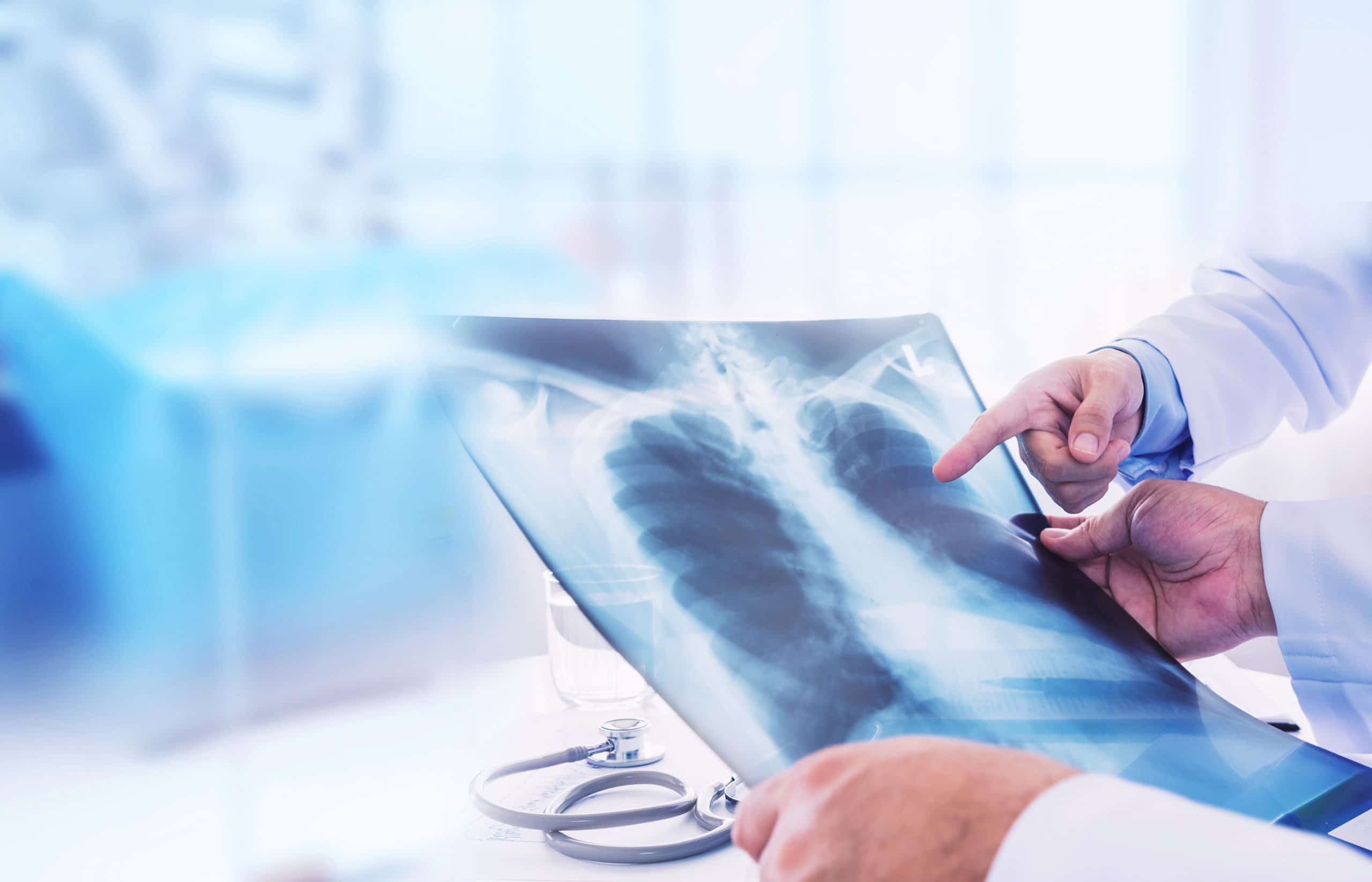 Why Mesothelioma Has Been in the News Recently