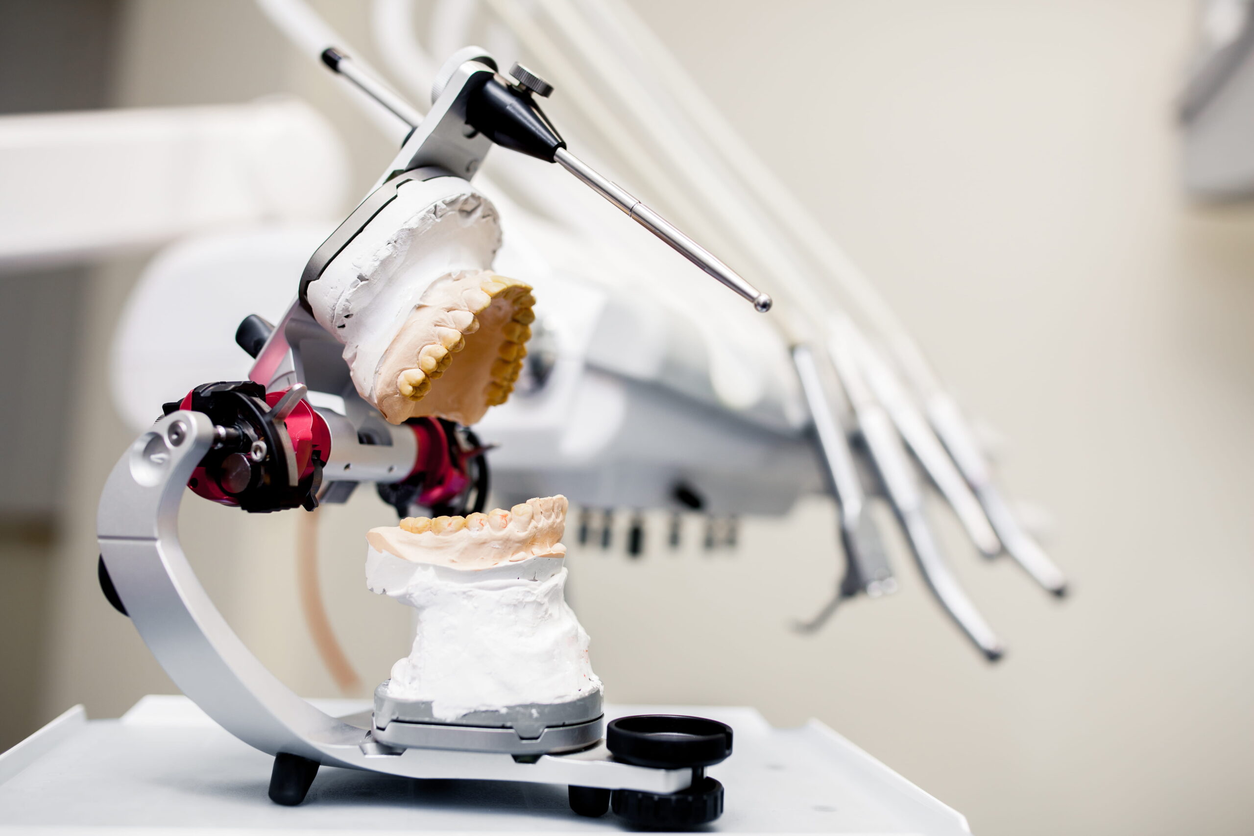 Implant Analogs: A Critical Component in Implant Laboratory Workflows